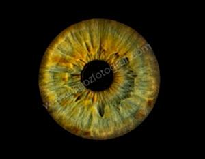 Dijital Göz Fotoğrafları