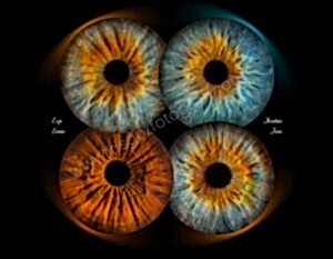 Dijital Göz Fotoğrafları